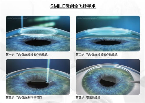 眼科謠言，你的“好心轉載”辦了多少壞事