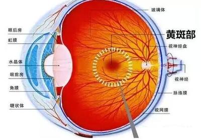 老年人眼底出血要根據綜合身體情況來診療