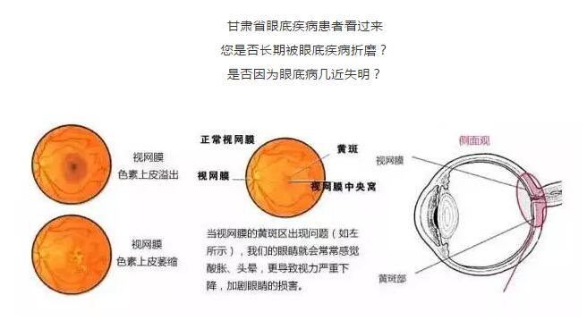 9月1日廣州中山大學(xué)眼科教授張少?zèng)_來蘭會(huì)診